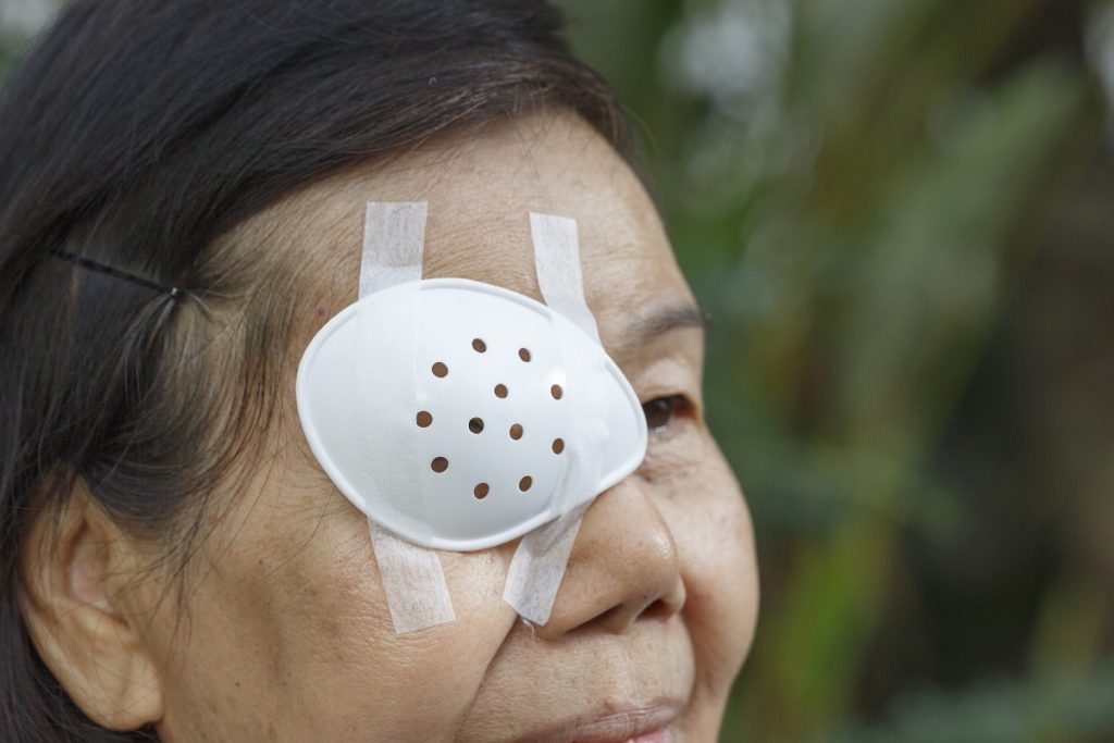 Elderly woman using an eye shield covering after cataract surgery.