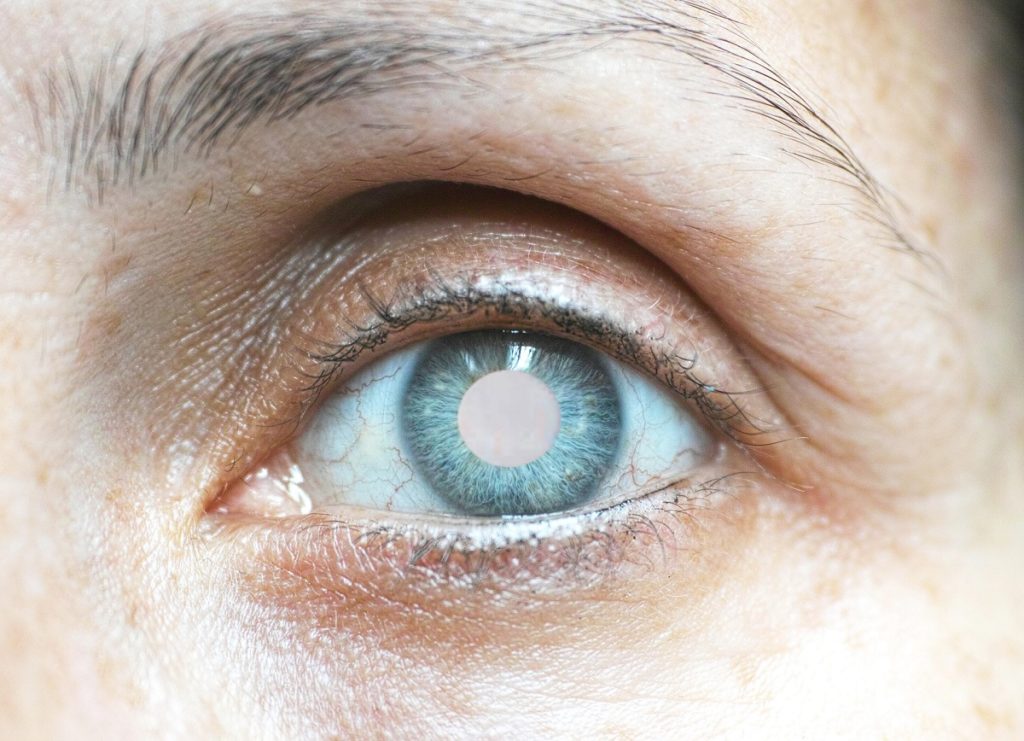 Close up of a womans left eye that has a cataract